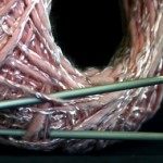 gestrickte-stromspeicher